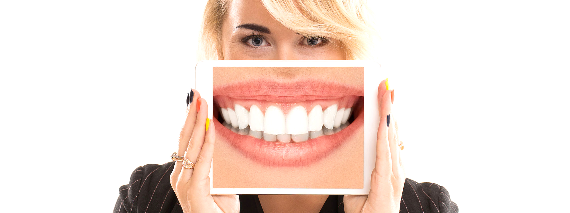 Two woman look at the tooth picture on a tablet at dentist offic