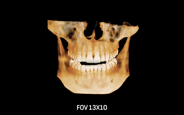 Green18-13×10-1-600×375