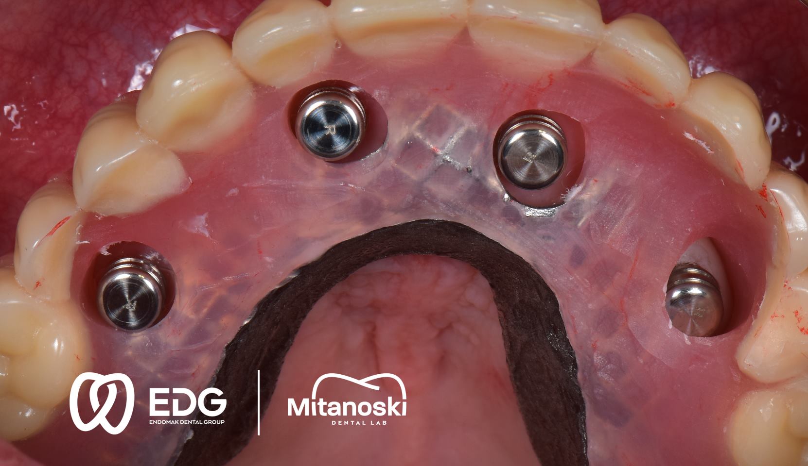 48378569_744816462543433_2181680448193691648_o