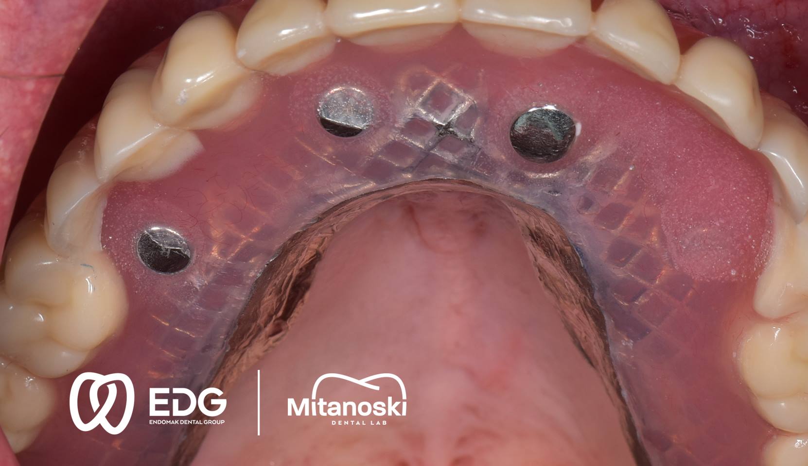 48416806_744816469210099_2301371729215225856_o